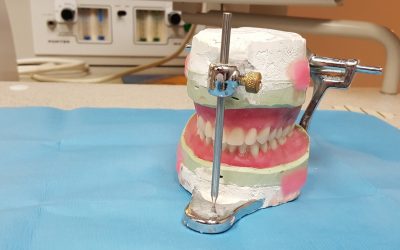 Fehlende Zähne ersetzen